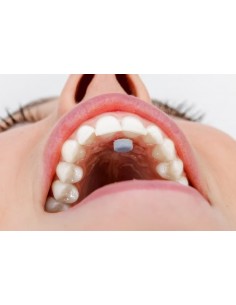 Myospots 50 pz. – Allenamento miofunzionale per postura linguale e respirazione nasale