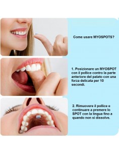 Myospots 50 pz. – Allenamento miofunzionale per postura linguale e respirazione nasale