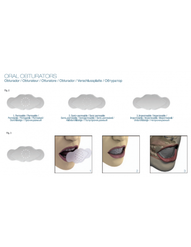 Otturatore Buccale Permeabile – Rieducazione della Respirazione Orale