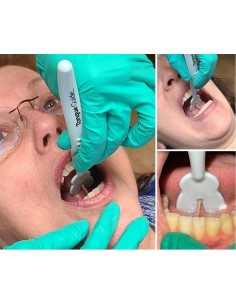 Guida linguale Tongue Guide Pro – professionale per valutazione e chirurgia del frenulo