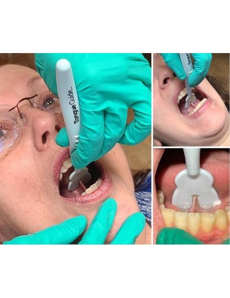 Retrattore Tongue Guide Pro – Guida linguale professionale per valutazione e chirurgia del frenulo