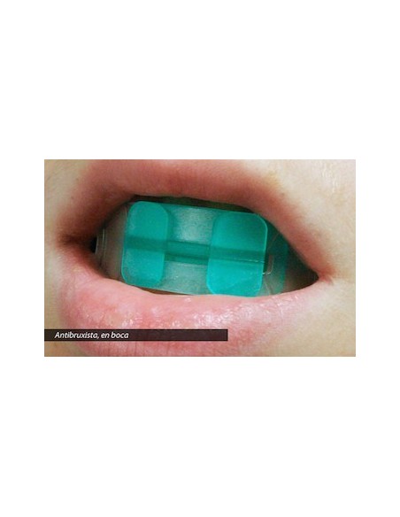 Bite Plane – Dispositivo per morso aperto