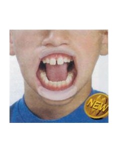 Divaricatore orale labiale