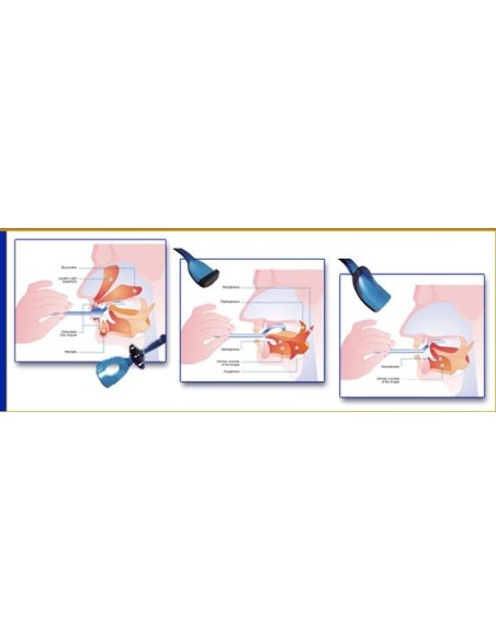 Kit OraLight adulti per esercizi oro-motori