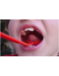 Elevatore linguale LifteR