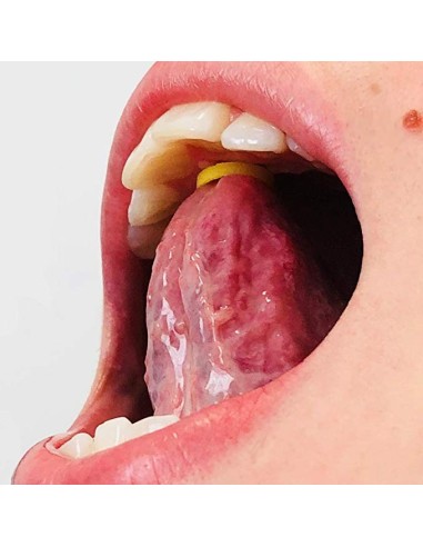 Elastici 3/16-4,8 mm ortodontici extra-orali colorati