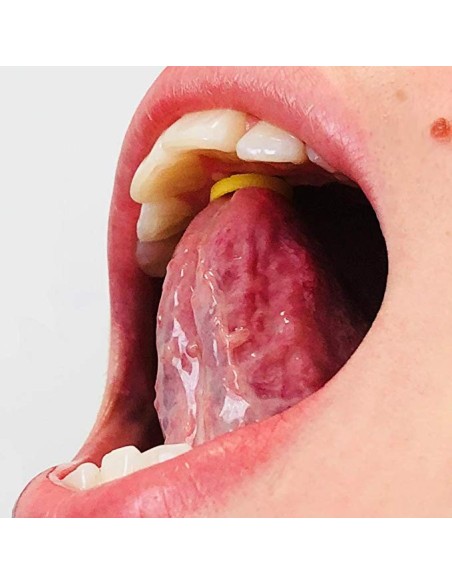 Elastici 3/16-4,8 mm ortodontici extra-orali colorati