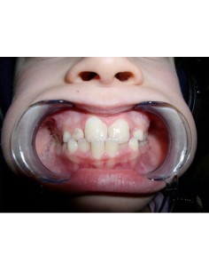 Apribocca Spandex 2 pz.