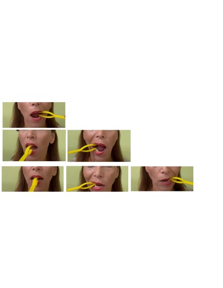 Sonda rinforzo labiale